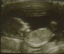 Baby's First Photo!!